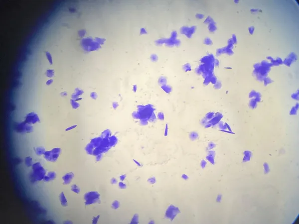 Citología vaginal teñida, campo microscópico