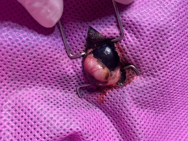 Corrección de ojo de cereza — resultado post-operatorio