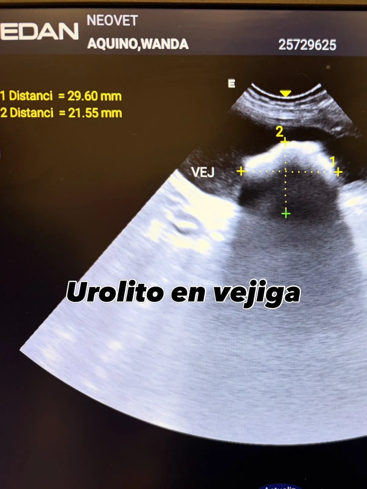 Imagen ecográfica: urolito en vejiga, con mediciones