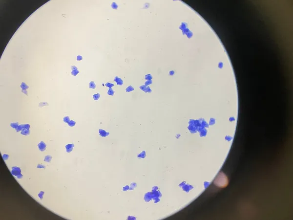 Análisis de espermatograma