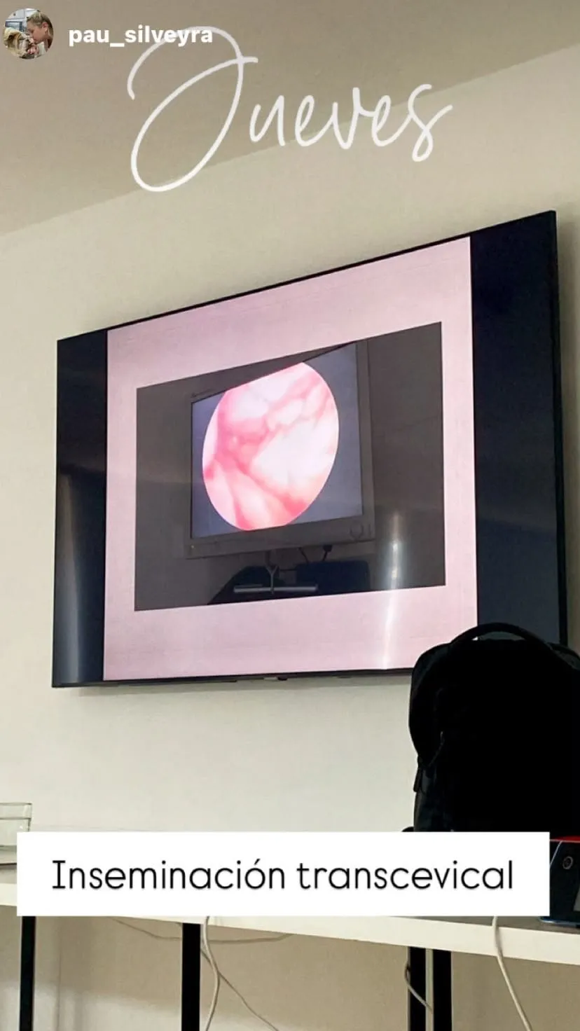 Inseminación transcervical en pantalla