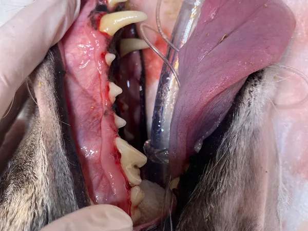 Limpieza dental profesional