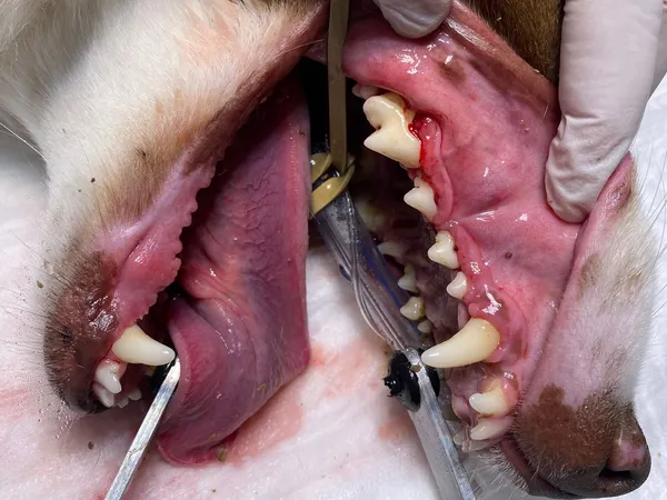 Procedimiento de limpieza dental