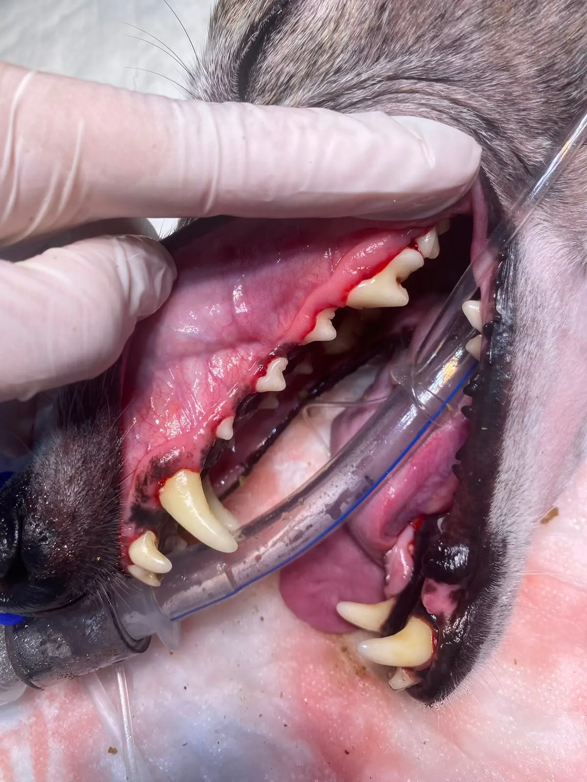 Tratamiento dental bajo anestesia, detalle